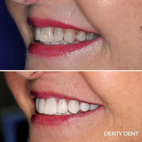 Clinica Dental Denty Dent calle Alcalá en pueblo nuevo logo